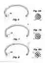 Fig. 05 - SURGICAL RETRACTOR HAVING RING OF VARIABLE DUROMETER