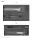 Fig. 03 - Tools for transoral surgery