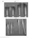 Fig. 04 - Tools for transoral surgery