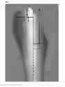 Fig. 06 - Tools for transoral surgery