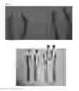 Fig. 07 - Tools for transoral surgery