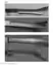 Fig. 10 - Tools for transoral surgery