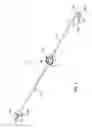 Fig. 02 - Ureteral bypass devices and procedures