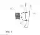 Fig. 02 - METHODS OF DIAGNOSIS AND OF SCREENING FOR ELECTRICAL MARKERS FOR HIDDEN (OCCULT) MALADIES AND MODULATION OF ENDOGENOUS BIOELECTRICAL NEURONAL SIGNALS IN PATIENTS