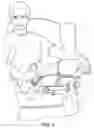 Fig. 02 - MEDICAL DEVICE
