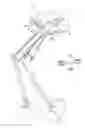 Fig. 01 - Walking assistance device