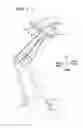 Fig. 02 - Walking assistance device