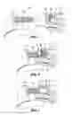 Fig. 04 - Knee brace