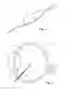 Fig. 03 - Vitrectomy probe with adjustable cutter port size