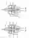 Fig. 10 - Vitrectomy probe with adjustable cutter port size