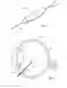 Fig. 03 - Vitrectomy probe with adjustable cutter port size