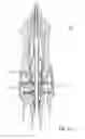Fig. 09 - Vitrectomy probe with adjustable cutter port size