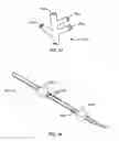 Fig. 02 - CATHETER APPARATUS AND METHOD FOR ATHEROLYSIS