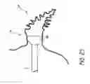 Fig. 22 - Method for accessing the left atrial appendage with a balloon-tipped transseptal sheath
