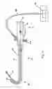 Fig. 02 - High pressure delivery system and method for treating pelvic disorder using large molecule therapeutics