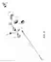 Fig. 16 - METHOD OF INSTALLING A CANNULA ASSEMBLY WITHIN A COAXIALLY-DRIVEN TISSUE ASPIRATION INSTRUMENT