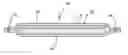 Fig. 01 - Absorbent article having improved bonding