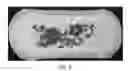 Fig. 10 - Article with heat-activatable expandable structures