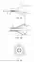 Fig. 06 - Method for the detection and treatment of aberrant neural-electric activity