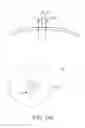 Fig. 19 - Method for the detection and treatment of aberrant neural-electric activity