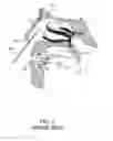 Fig. 03 - Enhanced systems, processes and apparatus for facilitating intranasal treatment of a patient and products thereby