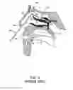 Fig. 04 - Enhanced systems, processes and apparatus for facilitating intranasal treatment of a patient and products thereby