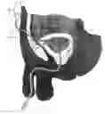 Fig. 01 - Catheters