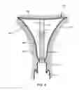 Fig. 05 - Ablation device