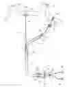 Fig. 01 - Method for ablating body tissue