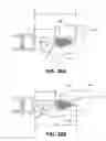 Fig. 27 - Method for ablating body tissue