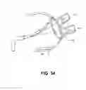 Fig. 33 - Method for ablating body tissue