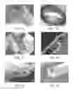 Fig. 02 - Tuned RF energy and electrical tissue characterization for selective treatment of target tissues