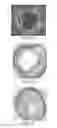 Fig. 03 - Tuned RF energy and electrical tissue characterization for selective treatment of target tissues