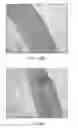 Fig. 48 - Tuned RF energy and electrical tissue characterization for selective treatment of target tissues