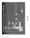 Fig. 55 - Tuned RF energy and electrical tissue characterization for selective treatment of target tissues