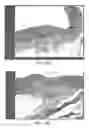 Fig. 58 - Tuned RF energy and electrical tissue characterization for selective treatment of target tissues