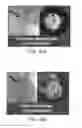 Fig. 63 - Tuned RF energy and electrical tissue characterization for selective treatment of target tissues