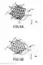 Fig. 06 - Irrigant distribution system for flexible electrodes