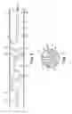Fig. 07 - OFF-WALL ELECTRODE DEVICE FOR RENAL NERVE ABLATION