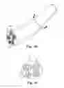 Fig. 05 - Bipolar Off-Wall Electrode Device for Renal Nerve Ablation
