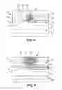 Fig. 06 - Bipolar Off-Wall Electrode Device for Renal Nerve Ablation