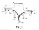 Fig. 11 - Bipolar Off-Wall Electrode Device for Renal Nerve Ablation