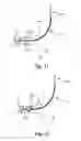 Fig. 13 - Bipolar Off-Wall Electrode Device for Renal Nerve Ablation