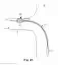 Fig. 15 - Bipolar Off-Wall Electrode Device for Renal Nerve Ablation