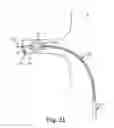 Fig. 16 - Bipolar Off-Wall Electrode Device for Renal Nerve Ablation
