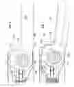 Fig. 06 - Cordless medical cauterization and cutting device