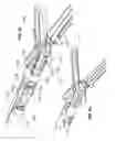 Fig. 33 - Cordless medical cauterization and cutting device
