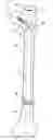 Fig. 01 - Fixation instrument for treating a bone fracture
