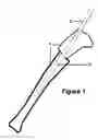 Fig. 02 - Guide device for insertion of blocking screws used to align insertion of intramedullary nail
