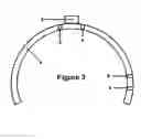 Fig. 04 - Guide device for insertion of blocking screws used to align insertion of intramedullary nail